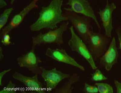 Immunocytochemistry/ Immunofluorescence - Anti-Cofilin antibody (AB11062), expandable thumbnail