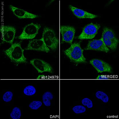 Immunocytochemistry/ Immunofluorescence - Anti-Cofilin antibody [EPR6375] - Loading Control (AB124979)