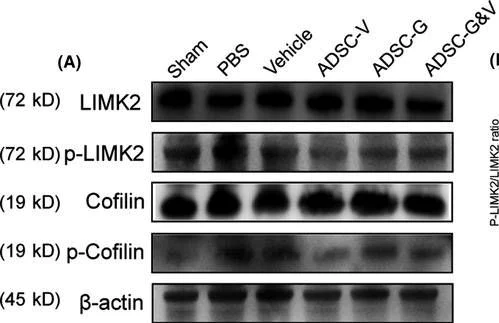 Western blot - Anti-Cofilin antibody [EPR6375] - Loading Control (AB124979)
