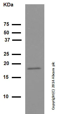 Western blot - Anti-Cofilin antibody [EPR6375] - Loading Control (AB124979)