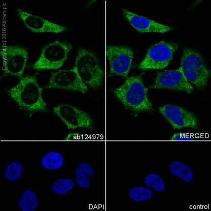 Immunocytochemistry/ Immunofluorescence - Anti-Cofilin antibody [EPR6375] - Loading Control (AB124979), expandable thumbnail