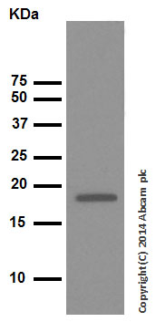 Western blot - Anti-Cofilin antibody [EPR6375] - Loading Control - Loading Control (AB124979), expandable thumbnail