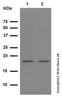 Western blot - Anti-Cofilin antibody [EPR6375] - Loading Control - Loading Control (AB124979), expandable thumbnail