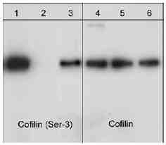 Western blot - Anti-Cofilin antibody - Loading Control (AB29038), expandable thumbnail