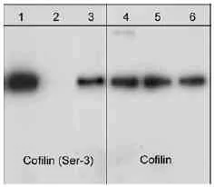 Western blot - Anti-Cofilin antibody - Loading Control (AB29038)