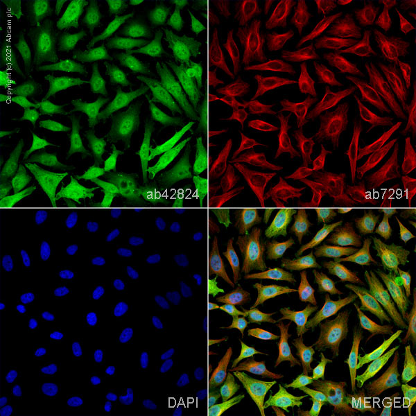 Immunocytochemistry/ Immunofluorescence - Anti-Cofilin antibody - Loading Control (AB42824), expandable thumbnail