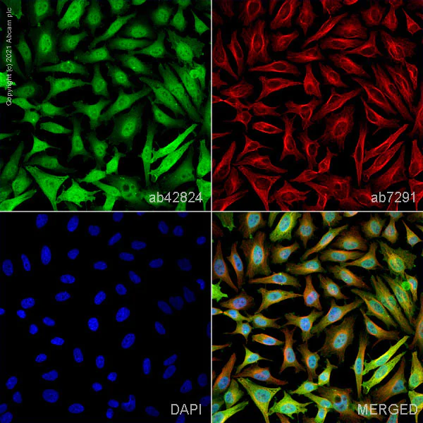 Immunocytochemistry/ Immunofluorescence - Anti-Cofilin antibody - Loading Control (AB42824)