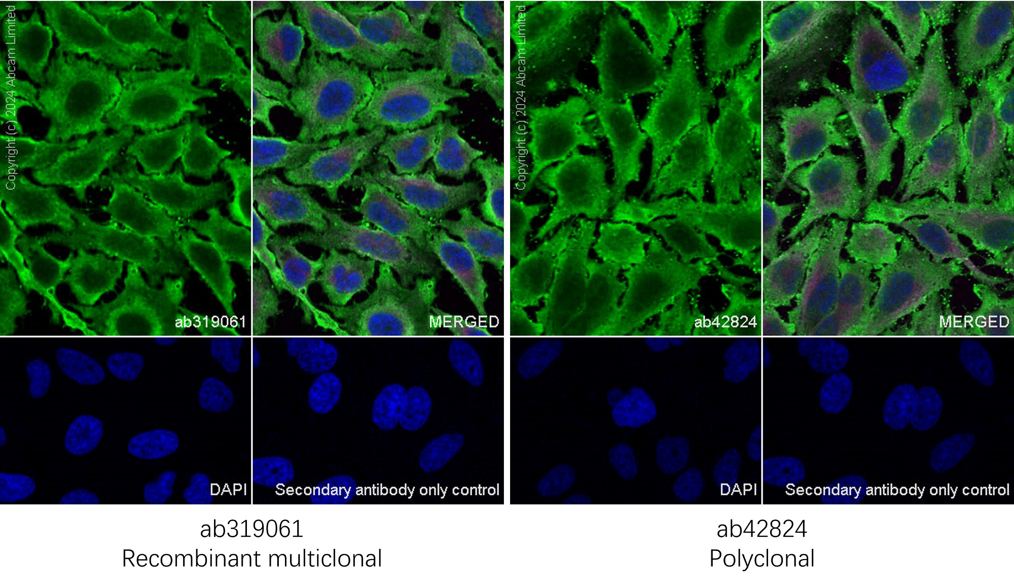 Immunocytochemistry/ Immunofluorescence - Anti-Cofilin antibody (ab42824), expandable thumbnail