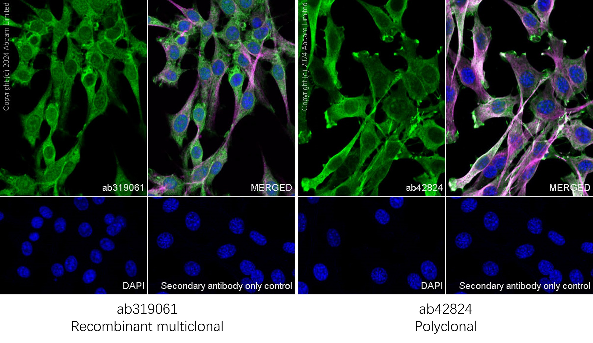 Immunocytochemistry/ Immunofluorescence - Anti-Cofilin antibody (ab42824), expandable thumbnail