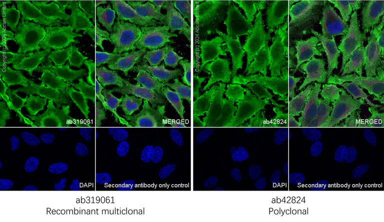Immunocytochemistry/ Immunofluorescence - Anti-Cofilin antibody [RM1210] - Loading Control (AB319061)