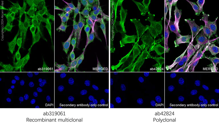Immunocytochemistry/ Immunofluorescence - Anti-Cofilin antibody [RM1210] - Loading Control (AB319061)
