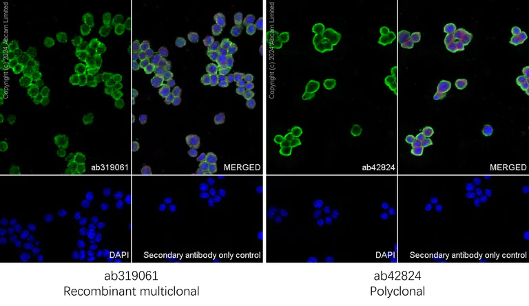Immunocytochemistry/ Immunofluorescence - Anti-Cofilin antibody [RM1210] - Loading Control (AB319061)