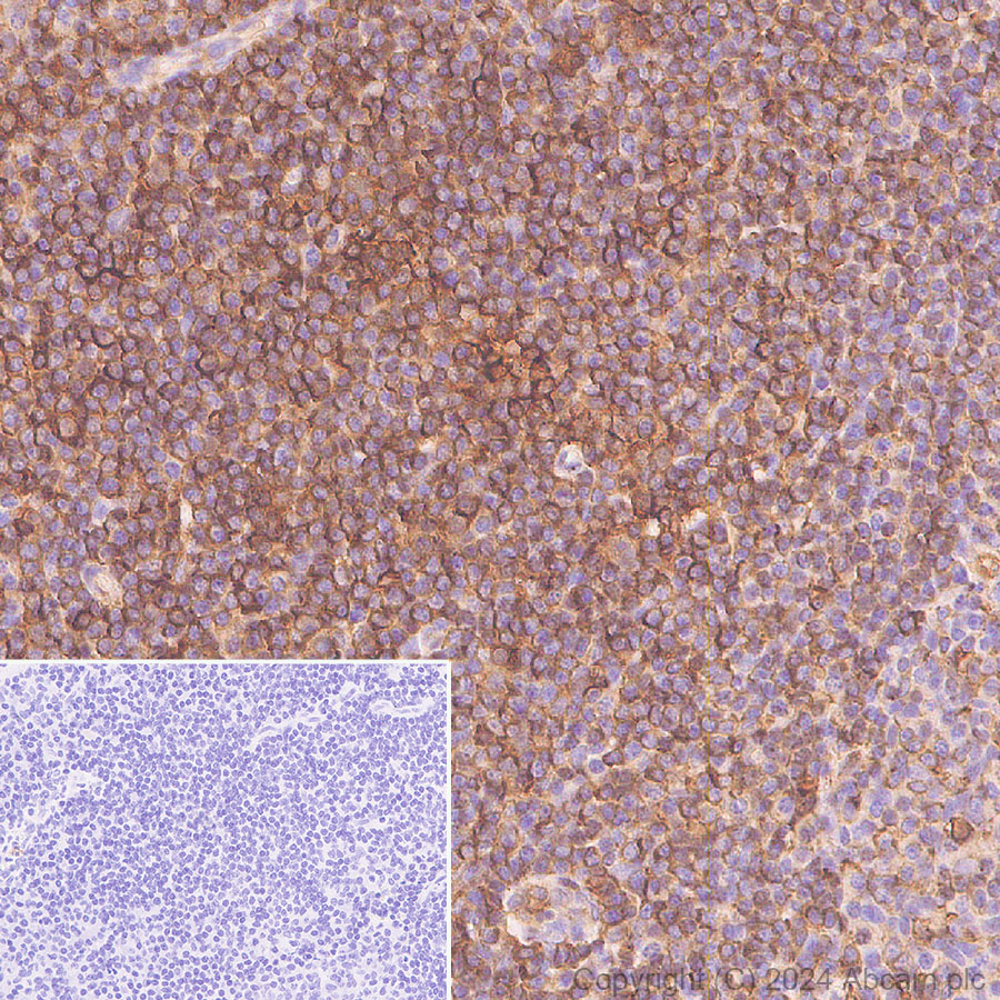 Immunohistochemistry (Formalin/PFA-fixed paraffin-embedded sections) - Anti-Cofilin antibody [RM1210] (ab319061), expandable thumbnail