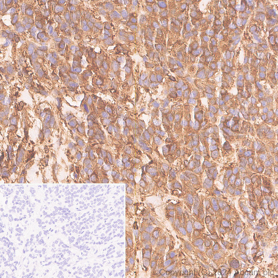Immunohistochemistry (Formalin/PFA-fixed paraffin-embedded sections) - Anti-Cofilin antibody [RM1210] (ab319061), expandable thumbnail