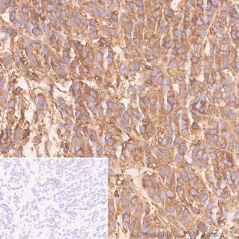 Immunohistochemistry (Formalin/PFA-fixed paraffin-embedded sections) - Anti-Cofilin antibody [RM1210] - Loading Control (AB319061)