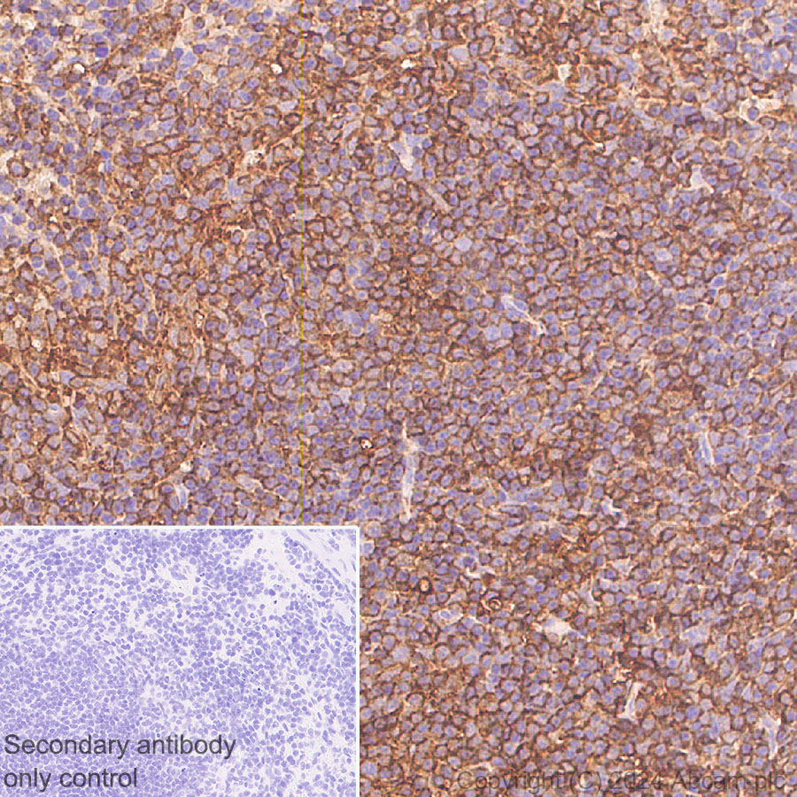 Immunohistochemistry (Formalin/PFA-fixed paraffin-embedded sections) - Anti-Cofilin antibody [RM1210] (ab319061), expandable thumbnail