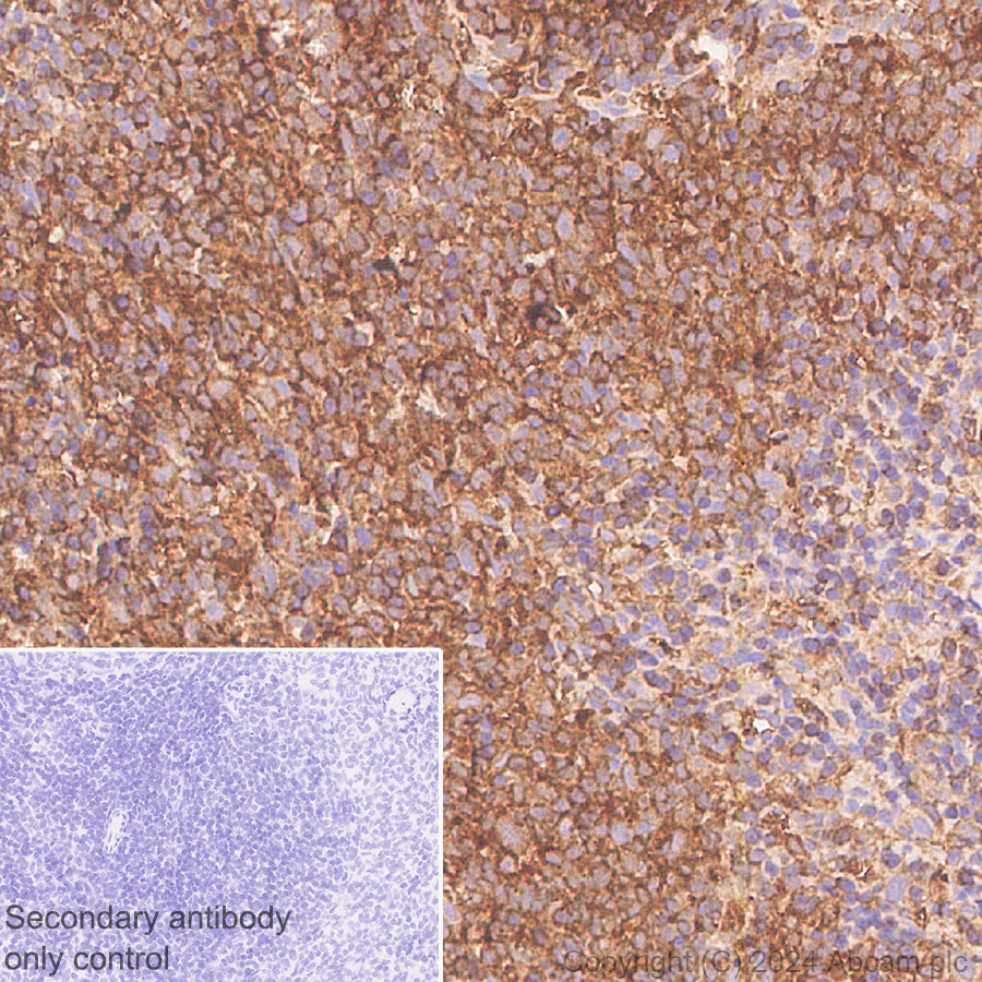 Immunohistochemistry (Formalin/PFA-fixed paraffin-embedded sections) - Anti-Cofilin antibody [RM1210] (ab319061), expandable thumbnail