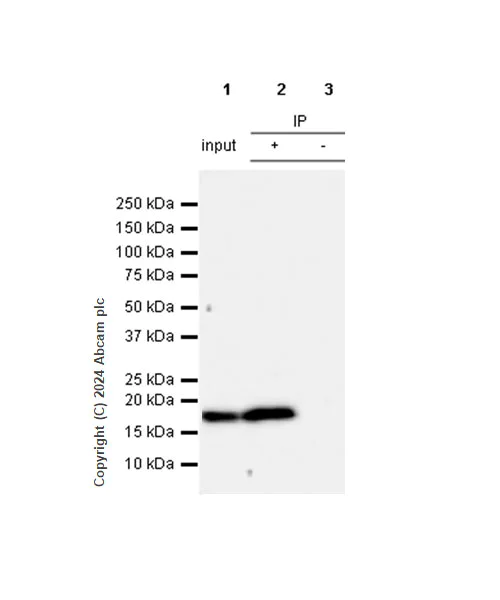 Immunoprecipitation - Anti-Cofilin antibody [RM1210] - Loading Control (AB319061)