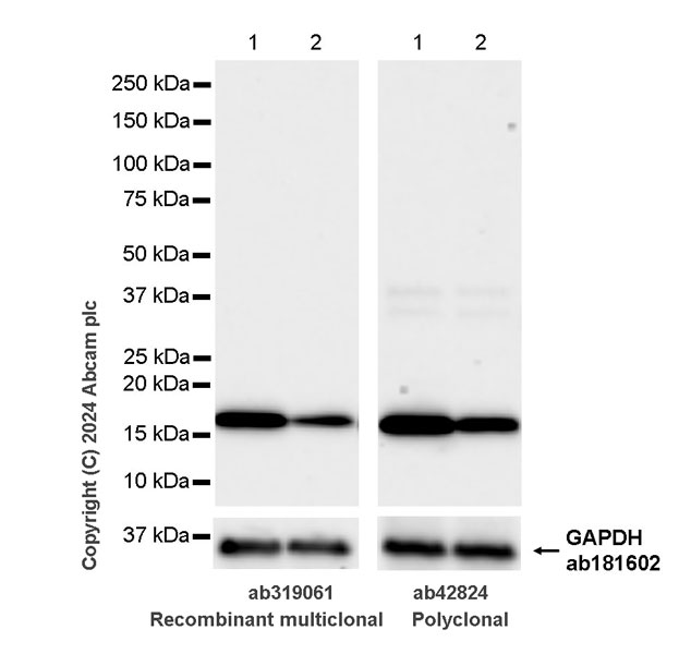 Western blot - Anti-Cofilin antibody [RM1210] - Loading Control (AB319061), expandable thumbnail