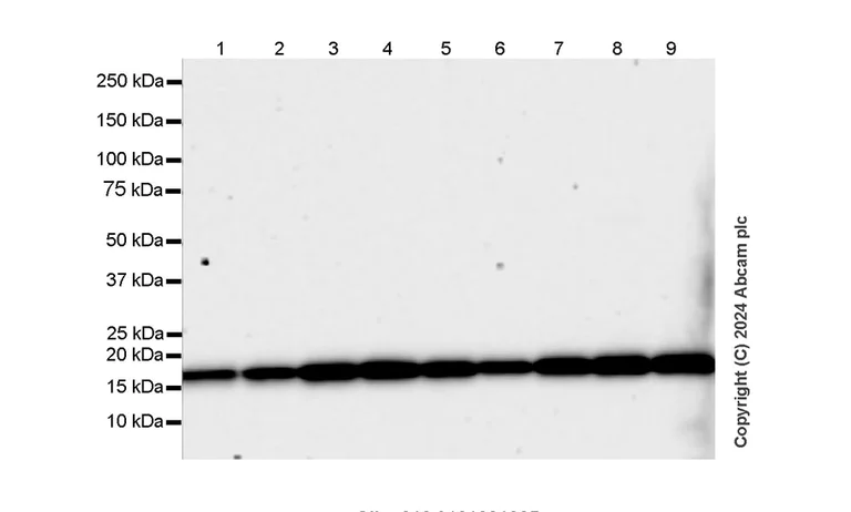 Western blot - Anti-Cofilin antibody [RM1210] - Loading Control (AB319061)