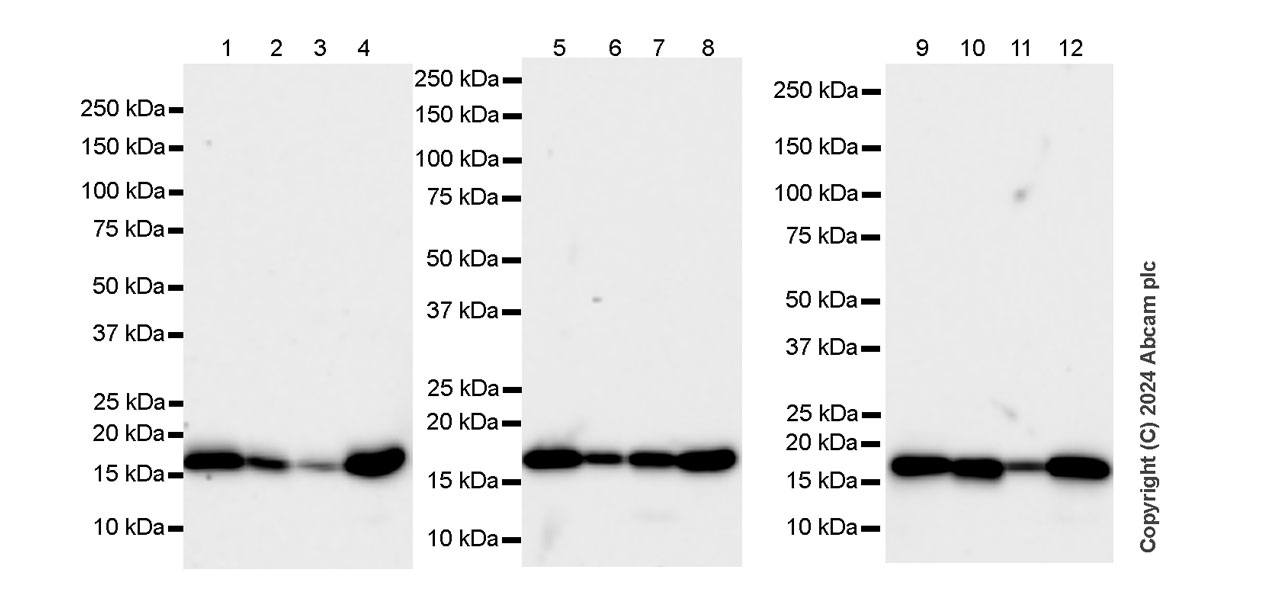 Western blot - Anti-Cofilin antibody [RM1210] - Loading Control (ab319061), expandable thumbnail
