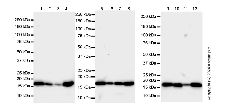 Western blot - Anti-Cofilin antibody [RM1210] - Loading Control (AB319061)