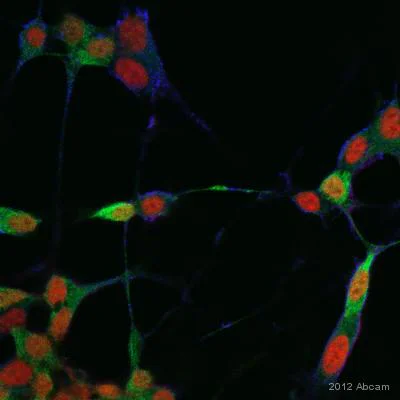Immunocytochemistry/ Immunofluorescence - Anti-Cofilin (phospho S3) antibody (AB12866)