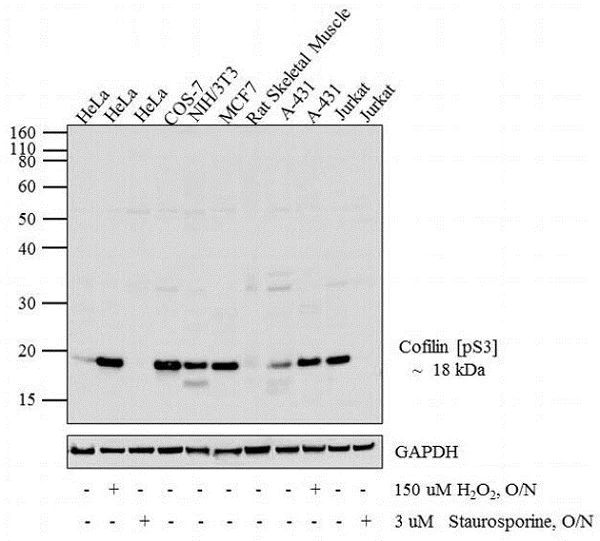 Western blot - Anti-Cofilin (phospho S3) antibody (AB12866)