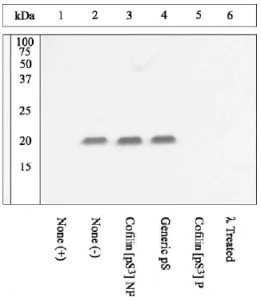 Western blot - Anti-Cofilin (phospho S3) antibody (AB12866)