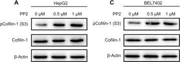 Western blot - Anti-Cofilin (phospho S3) antibody (AB12866)