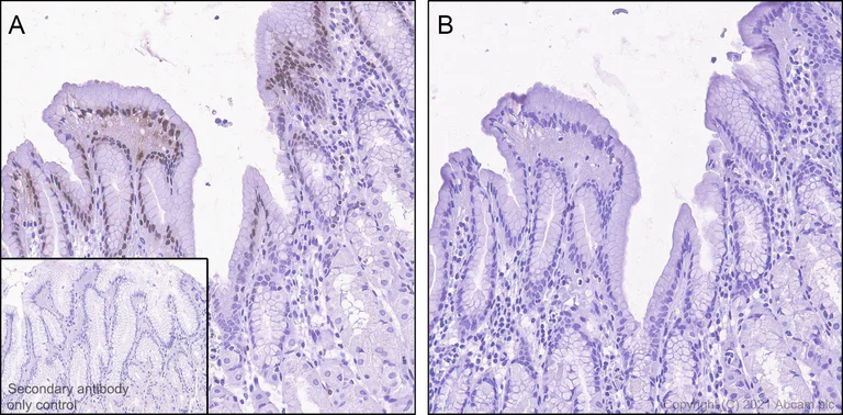 Immunohistochemistry (Formalin/PFA-fixed paraffin-embedded sections) - Anti-Cofilin (phospho S3) antibody [EPR24753-28] (AB283500)