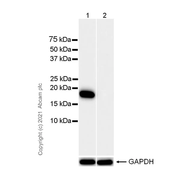 Western blot - Anti-Cofilin (phospho S3) antibody [EPR24753-28] (AB283500)