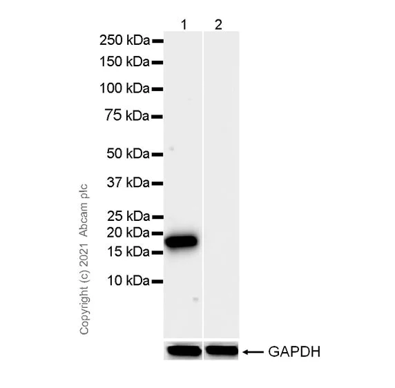 Western blot - Anti-Cofilin (phospho S3) antibody [EPR24753-28] (AB283500)