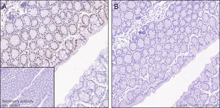 Immunohistochemistry (Formalin/PFA-fixed paraffin-embedded sections) - Anti-Cofilin (phospho S3) antibody [EPR24753-28] - BSA and Azide free (AB283513)