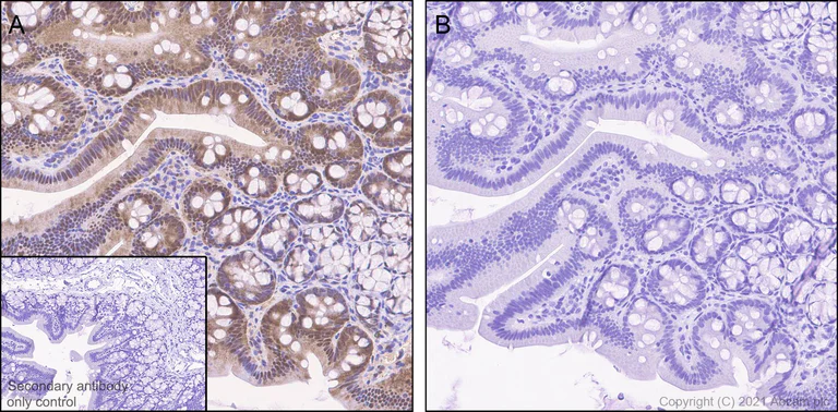 Immunohistochemistry (Formalin/PFA-fixed paraffin-embedded sections) - Anti-Cofilin (phospho S3) antibody [EPR24753-28] - BSA and Azide free (AB283513)