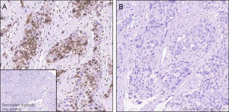 Immunohistochemistry (Formalin/PFA-fixed paraffin-embedded sections) - Anti-Cofilin (phospho S3) antibody [EPR24753-28] - BSA and Azide free (AB283513)