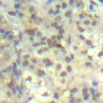Immunohistochemistry (Formalin/PFA-fixed paraffin-embedded sections) - Anti-Cofilin (phospho Y139) antibody (AB194783)