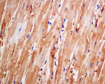 Immunohistochemistry (Formalin/PFA-fixed paraffin-embedded sections) - Anti-COG4 antibody [EPR10111] (AB154795)