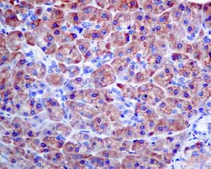 Immunohistochemistry (Formalin/PFA-fixed paraffin-embedded sections) - Anti-COG4 antibody [EPR10111] (AB154795)