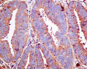 Immunohistochemistry (Formalin/PFA-fixed paraffin-embedded sections) - Anti-COG4 antibody [EPR10111] (AB154795)