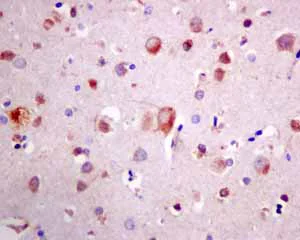 Immunohistochemistry (Formalin/PFA-fixed paraffin-embedded sections) - Anti-COG4 antibody [EPR10111] (AB154795)