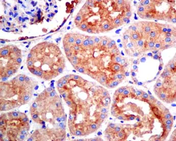 Immunohistochemistry (Formalin/PFA-fixed paraffin-embedded sections) - Anti-COG4 antibody [EPR10111] - BSA and Azide free (AB249103)