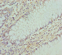 Immunohistochemistry (Formalin/PFA-fixed paraffin-embedded sections) - Anti-COG5 antibody (AB229830), expandable thumbnail
