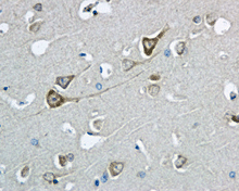 Immunohistochemistry (Formalin/PFA-fixed paraffin-embedded sections) - Anti-COG7 antibody [EPR9942] - BSA and Azide free (AB249458), expandable thumbnail