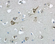Immunohistochemistry (Formalin/PFA-fixed paraffin-embedded sections) - Anti-COG7 antibody [EPR9942] - BSA and Azide free (AB249458)
