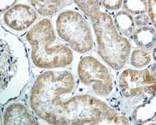 Immunohistochemistry (Formalin/PFA-fixed paraffin-embedded sections) - Anti-COG7 antibody [EPR9942] - BSA and Azide free (AB249458), expandable thumbnail