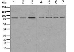 Western blot - Anti-COG7 antibody [EPR9942] - BSA and Azide free (AB249458), expandable thumbnail