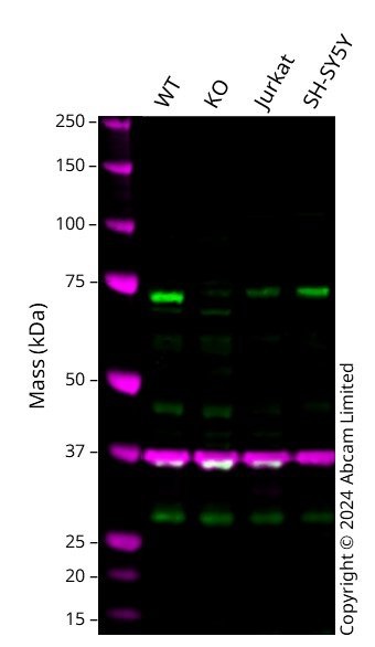Western blot - Anti-Coilin antibody (AB210785)