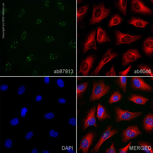 Immunocytochemistry - Anti-Coilin antibody [IH10] (AB87913)