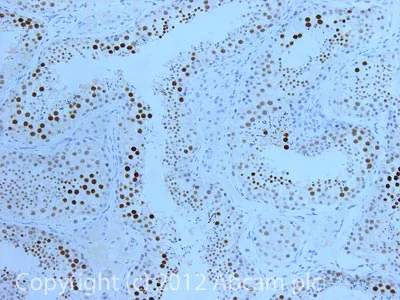 Immunohistochemistry (Formalin/PFA-fixed paraffin-embedded sections) - Anti-Coilin antibody [IH10] (AB87913)